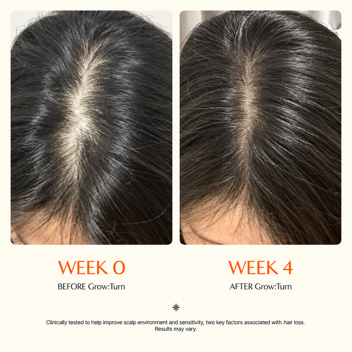Korea's #1 Hair Growth Serum